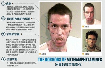 ​触目惊心！脓包、溃烂、发黑，为什么吸毒会导致如此严重的皮肤病