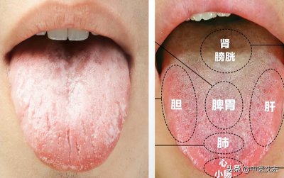 ​舌苔发白增厚是什么原因 舌苔发白、且厚腻？可能是身体在传递3个坏消息！别不