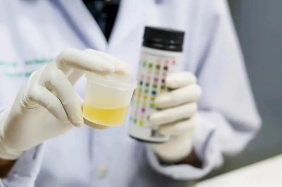 ​日常生活中如何辨别“泡沫尿”以尽早发现危险因素呢？