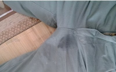 ​男人患上早泄，不治疗不吃药能好吗？