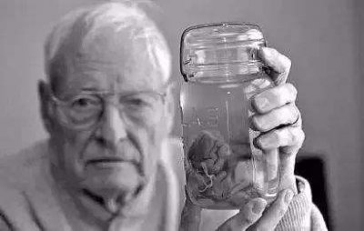 ​关于爱因斯坦大脑的秘密，众多科学家都给了解释，谁最靠谱？