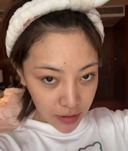 ​温精灵，温精灵整容医院