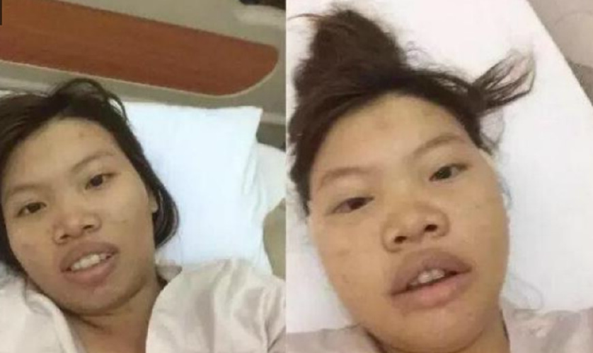 整容后的凤姐,延禧攻略整容脸,本文共(7669字) 整容后的凤姐,延禧攻略整容脸,本文共(7669字)