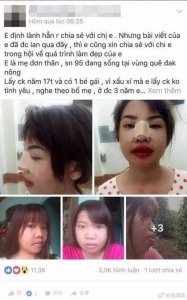 ​整容后的凤姐，延禧攻略整容脸