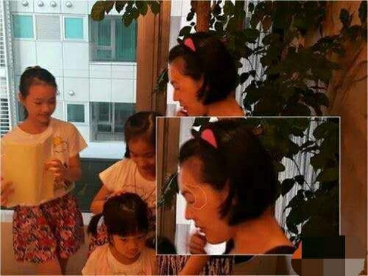 周冬雨下巴的疤痕怎么弄得「素颜的周冬雨下巴现3厘米疤痕而今才知道杨幂爱照半边脸的原因」