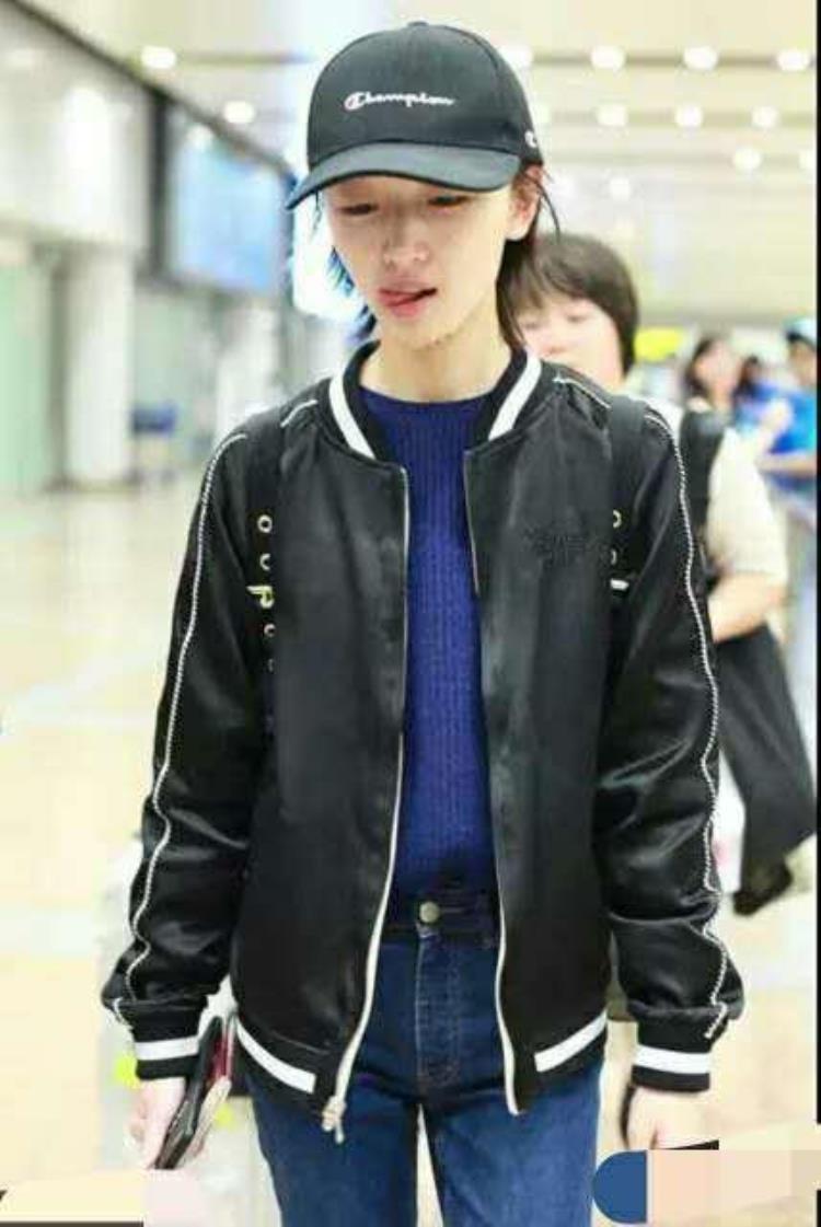 周冬雨下巴的疤痕怎么弄得「素颜的周冬雨下巴现3厘米疤痕而今才知道杨幂爱照半边脸的原因」