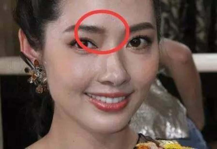 周冬雨下巴的疤痕怎么弄得「素颜的周冬雨下巴现3厘米疤痕而今才知道杨幂爱照半边脸的原因」