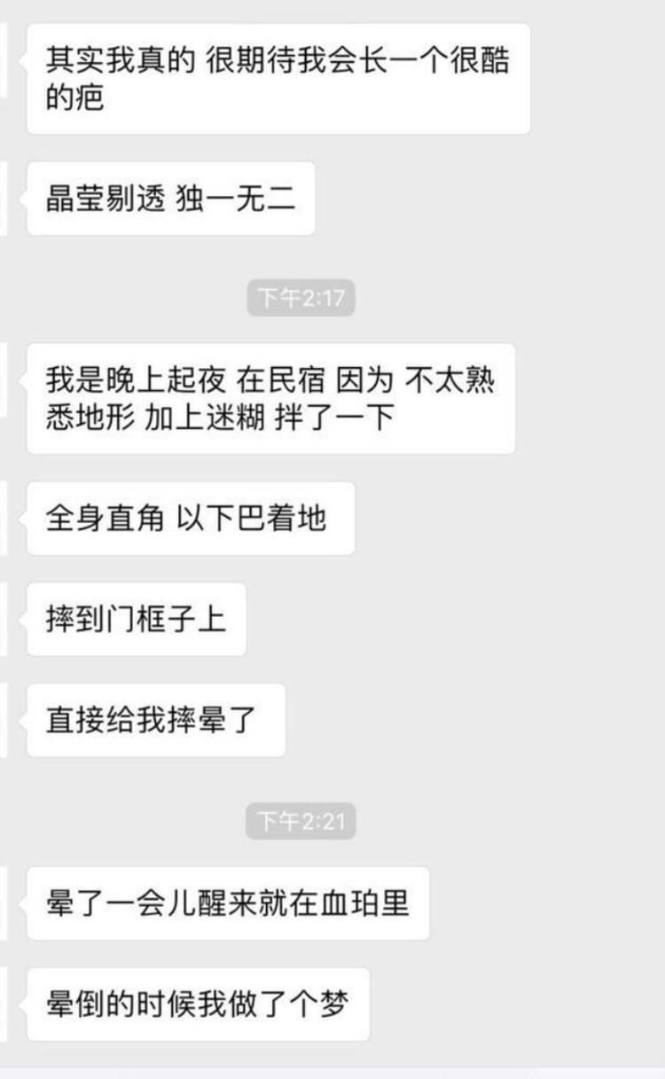 周冬雨下巴的疤痕怎么弄得「素颜的周冬雨下巴现3厘米疤痕而今才知道杨幂爱照半边脸的原因」