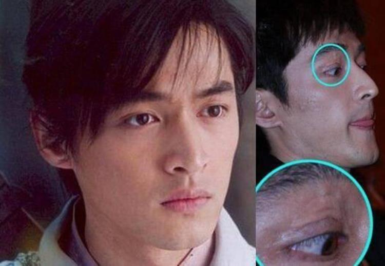 周冬雨下巴的疤痕怎么弄得「素颜的周冬雨下巴现3厘米疤痕而今才知道杨幂爱照半边脸的原因」