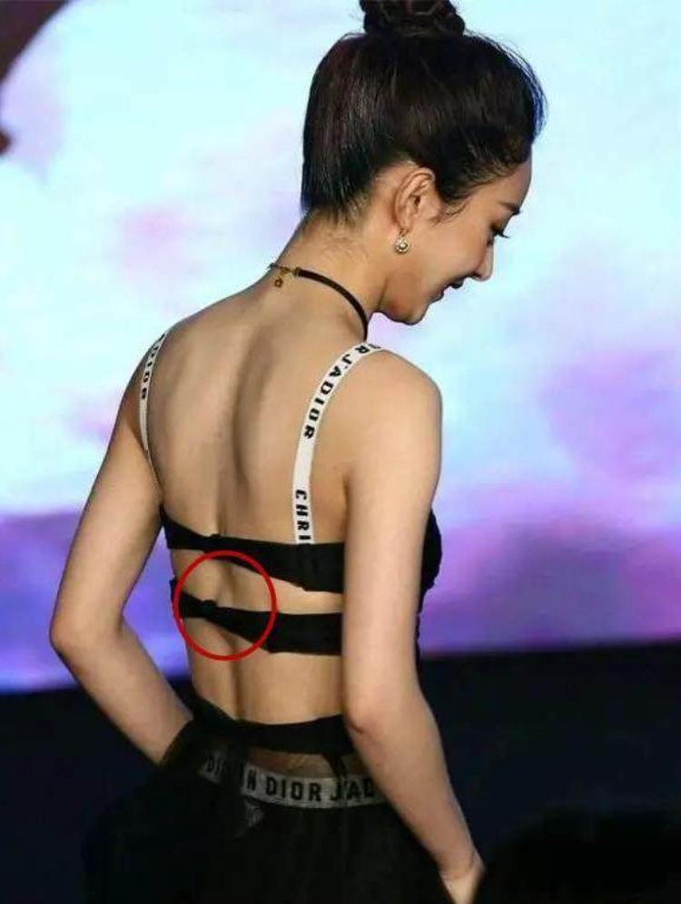 周冬雨下巴的疤痕怎么弄得「素颜的周冬雨下巴现3厘米疤痕而今才知道杨幂爱照半边脸的原因」