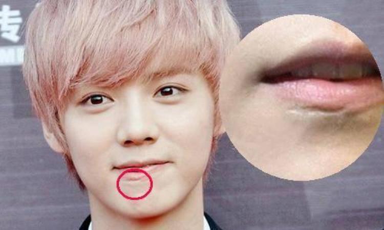 周冬雨下巴的疤痕怎么弄得「素颜的周冬雨下巴现3厘米疤痕而今才知道杨幂爱照半边脸的原因」