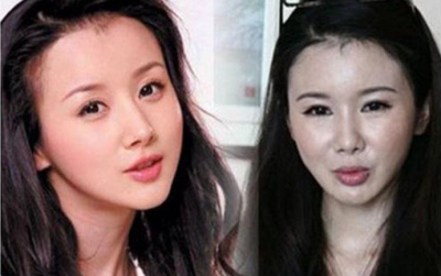 郑爽整形,郑爽以前旧照片(郑爽刚整容照片)