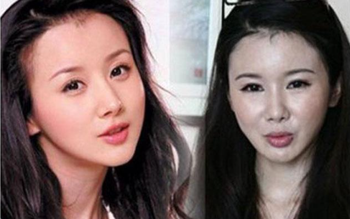 郑爽整形,郑爽以前旧照片(郑爽刚整容照片) 郑爽整形,郑爽以前旧照片(郑爽刚整容照片)