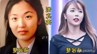 明星整容失败前后对照的图片,韩国这些明星整容前后对比