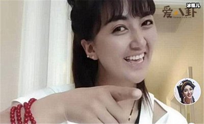 ​拉姆遭前夫报复烧伤，病情恶化去世！