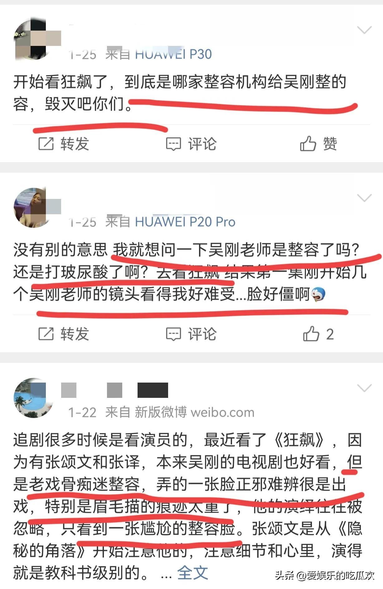 吴刚整容终于真相大白，原来脸肿不是因为打了玻尿酸，而是太敬业